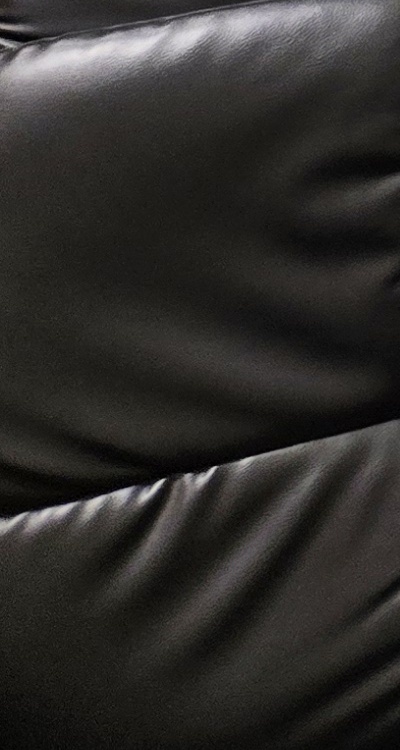 돌출입 팔자주름 교정 얼마나 바뀔까요 관련 이미지 42