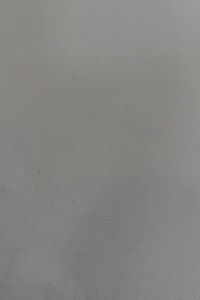 부정교합 교정 안하면 생기는 문제는 뭔가요 관련 이미지 55