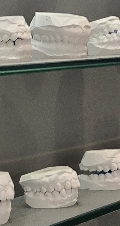 완전매복사랑니 발치 대학병원 꼭 가야하나요 관련 이미지 34