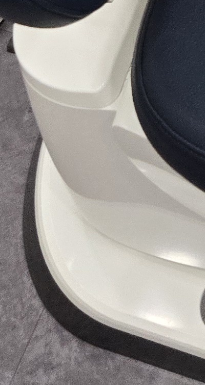 치아 사이 벌어짐 심해지는 이유부터 알아보면 관련 이미지 42