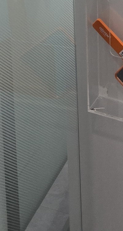 충치 검은점 나타났다면 이렇게 대처해요 관련 이미지 45