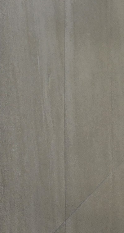 앞니 신경치료 크라운 까지 해야할 상황이라면 관련 이미지 48