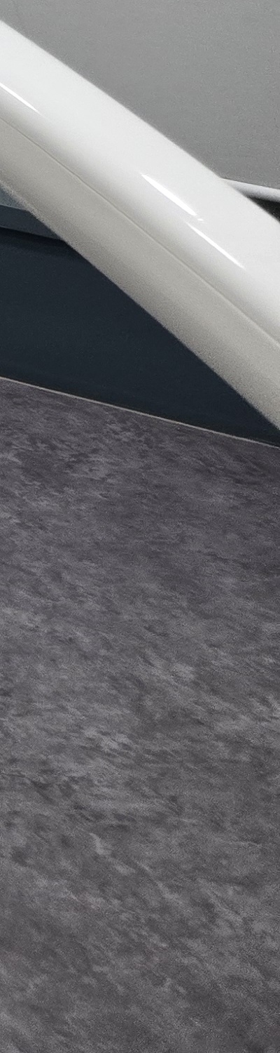 치과 치아미백 효과 어떤식으로 나타날까 관련 이미지 29