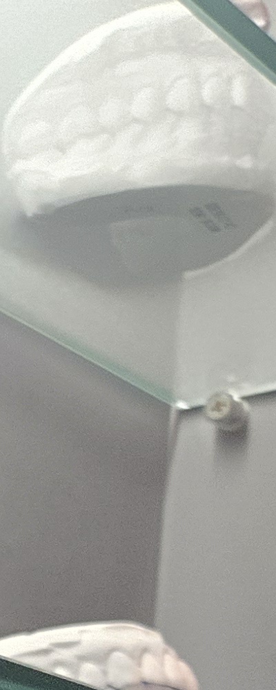 어르신 임플란트 지원 현명하게 활용하려면 관련 이미지 20