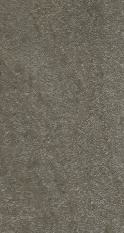 앞니 신경치료 크라운 까지 해야할 상황이라면 관련 이미지 31