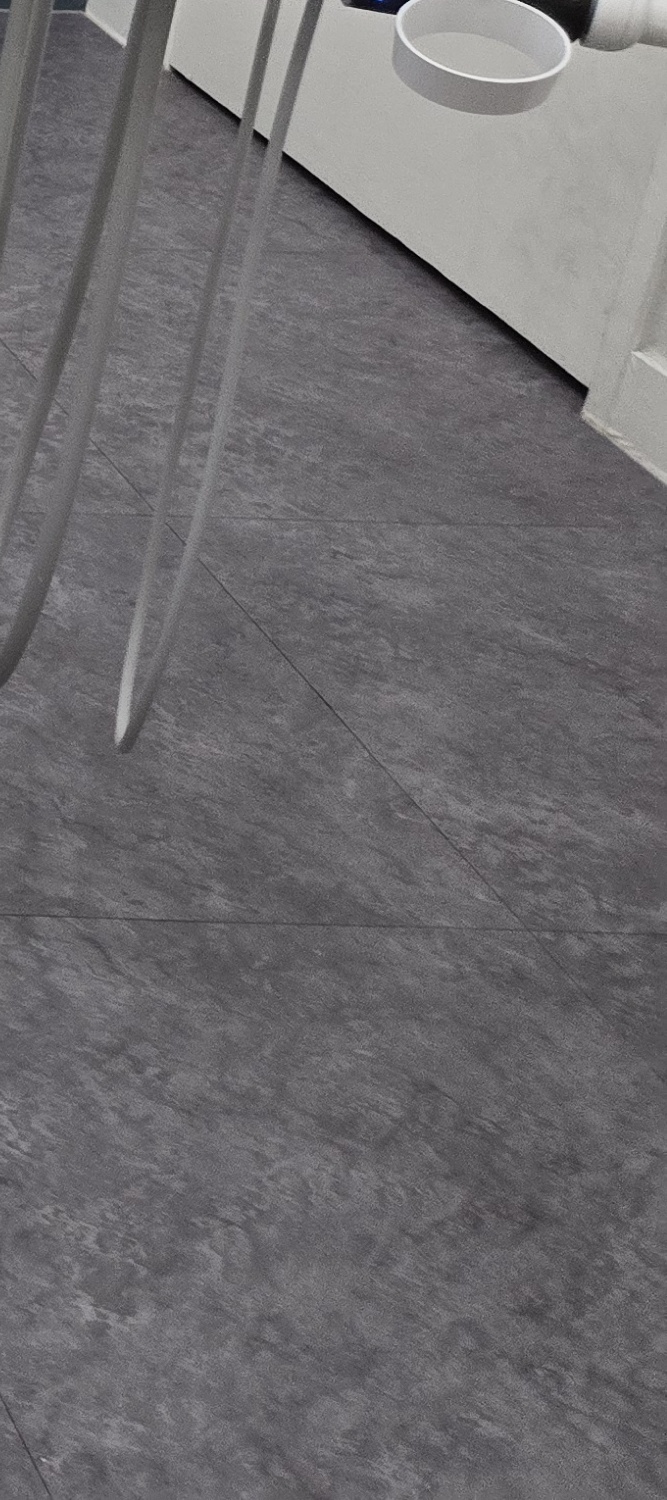 비발치 돌출입 교정 어떨때 적절할까 관련 이미지 21