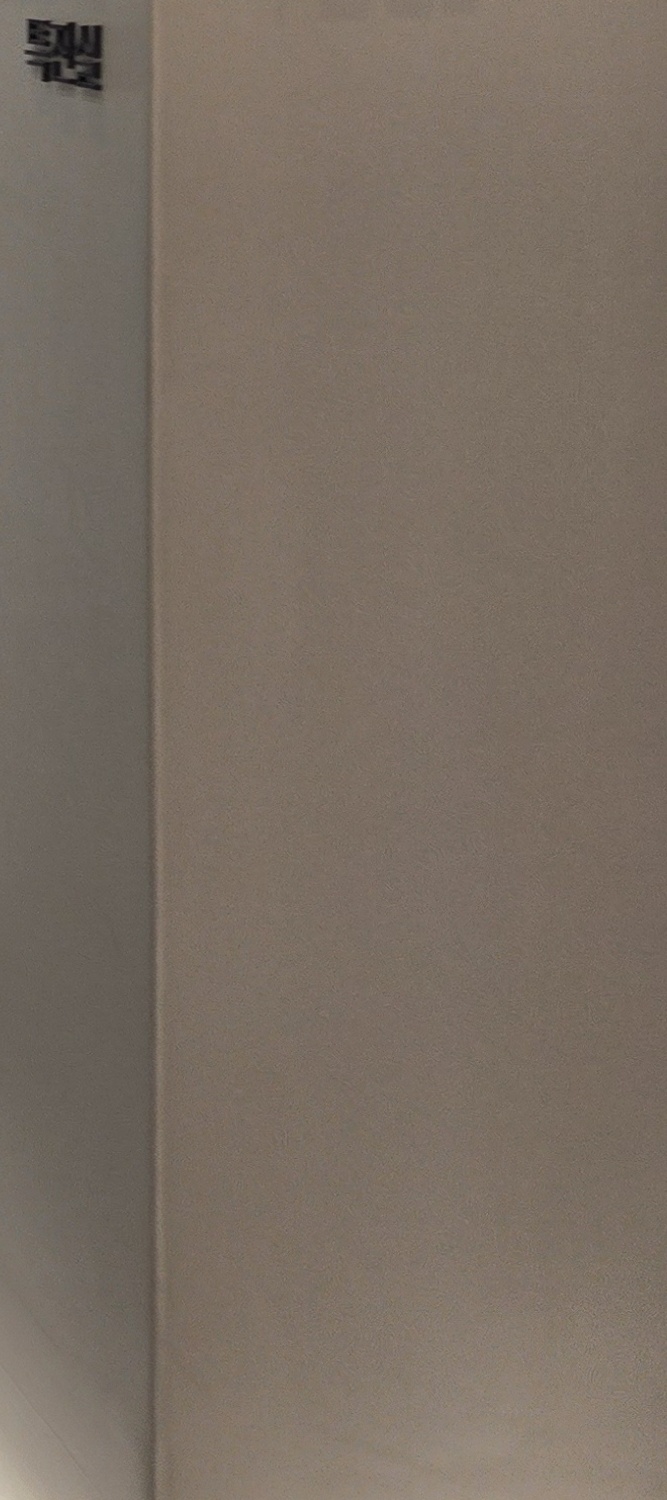 Can Crooked Lower Teeth Be Improved Without Extraction? image 34