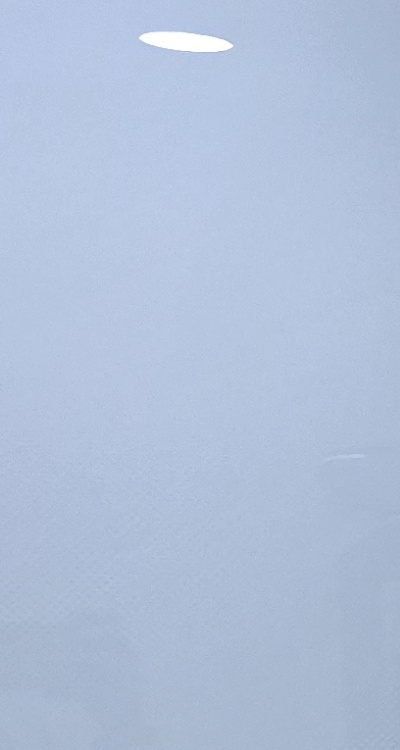 사랑니 발치 후 충치 치료 둘다 준비하려면 관련 이미지 22