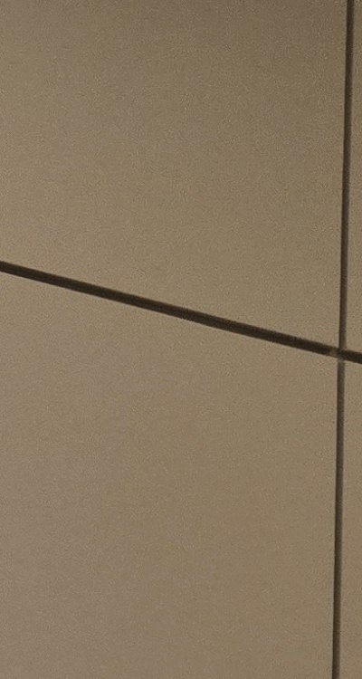 사랑니 발치 후 충치 치료 둘다 준비하려면 관련 이미지 17