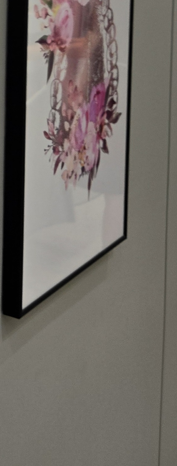 충치 치아 깨짐 시점이 관건이라면 관련 이미지 23