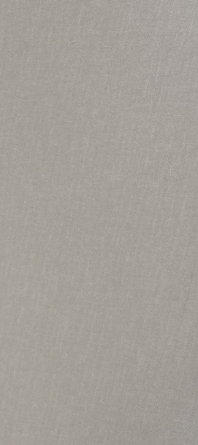 앞니 틀어짐 교정 방법 이럴때는 좀더 간단해요 관련 이미지 14