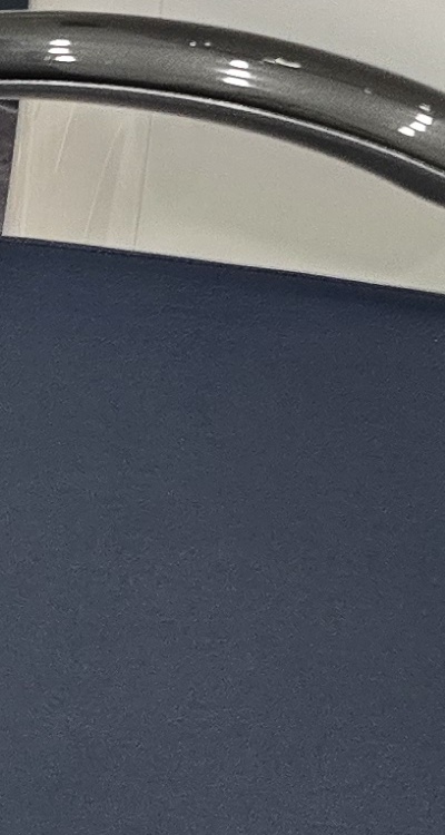 치아 사이 벌어짐 심해지는 이유부터 알아보면 관련 이미지 34