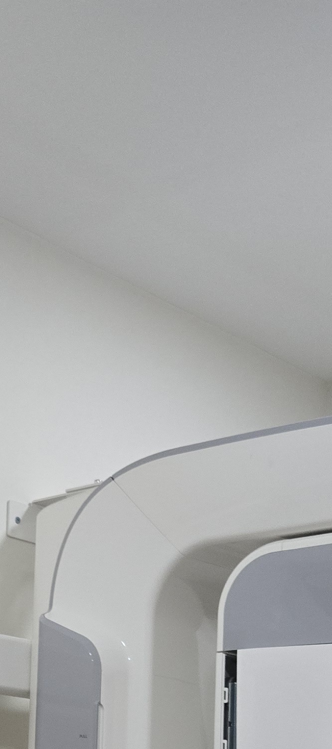 벌어진 앞니 교정 체계적으로 대비하려면 관련 이미지 27