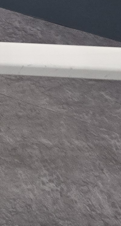 어금니 임플란트 안하면 후회하게 되는걸까 관련 이미지 41