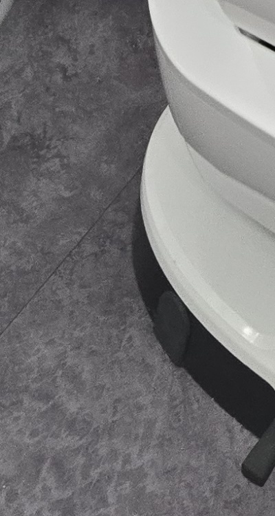 어금니 임플란트 안하면 후회하게 되는걸까 관련 이미지 47