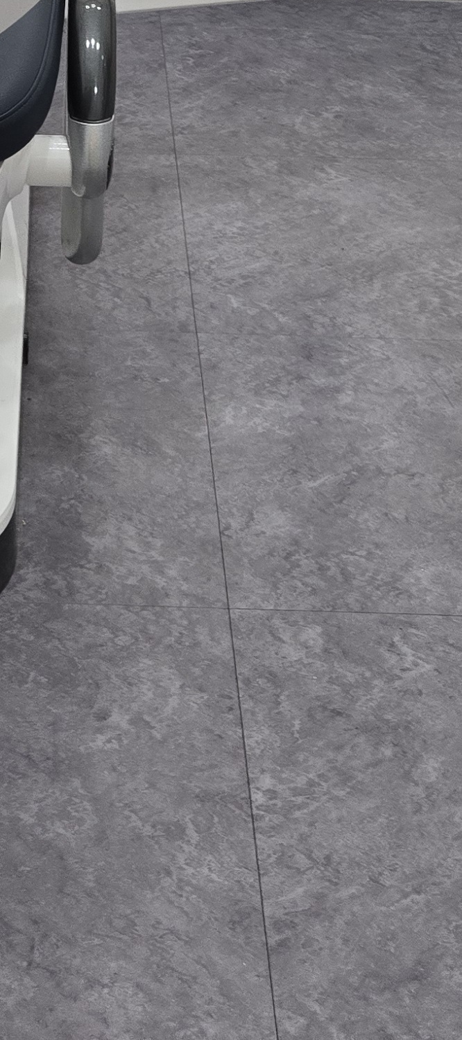 비발치 돌출입 교정 어떨때 적절할까 관련 이미지 19