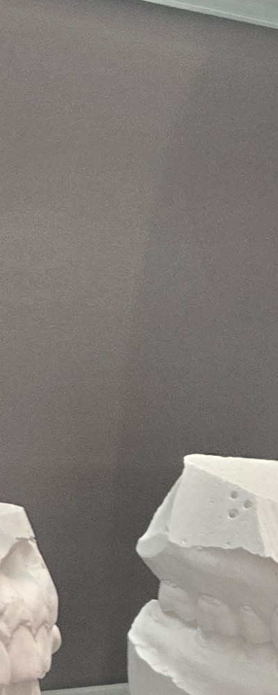 어르신 임플란트 지원 현명하게 활용하려면 관련 이미지 27