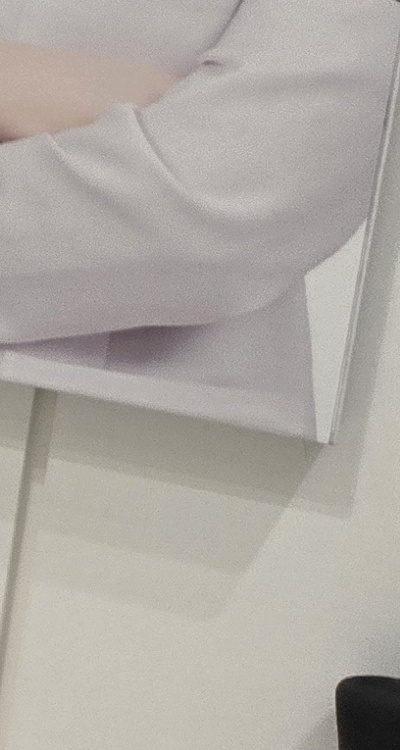 송곳니 크라운 티가 안나게 해결 가능한건가요 관련 이미지 39