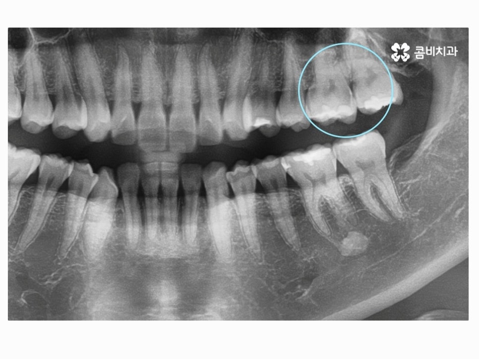 명동치과 누구나 놓치기 쉬운 문제점은! 관련 이미지 3