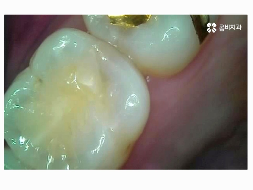 명동치과 누구나 놓치기 쉬운 문제점은! 관련 이미지 1