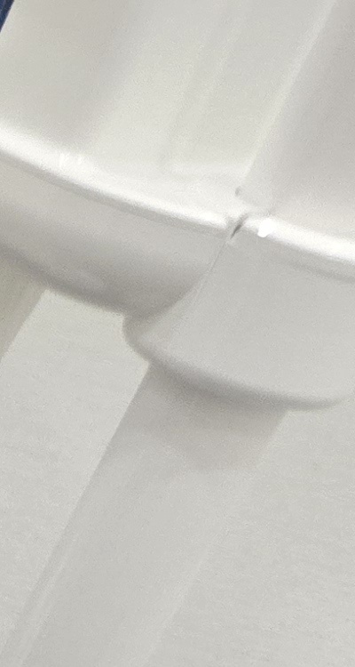 치아 사이 벌어짐 심해지는 이유부터 알아보면 관련 이미지 17