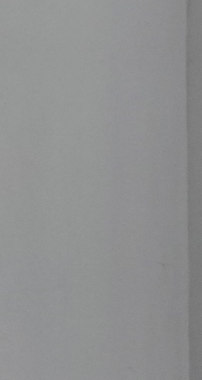 치아 발치 후 임플란트 언제부터 준비할까 관련 이미지 41