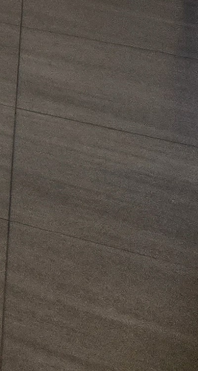 앞니 틀어짐 교정 조화롭게 마무리하려면 관련 이미지 48