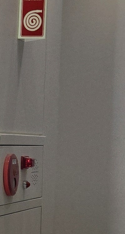 앞니 틀어짐 교정 조화롭게 마무리하려면 관련 이미지 26