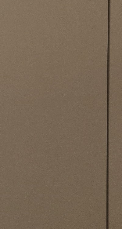 사랑니 발치 후 충치 치료 둘다 준비하려면 관련 이미지 37