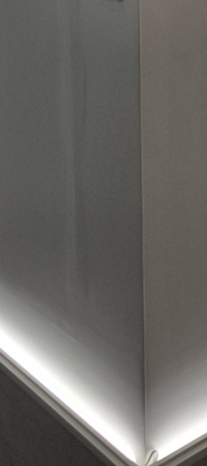 어금니 충치 단계 미리 알아차리려면 관련 이미지 21