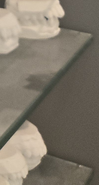 앞니 틀어짐 부분교정 얼마나 걸릴까 관련 이미지 49