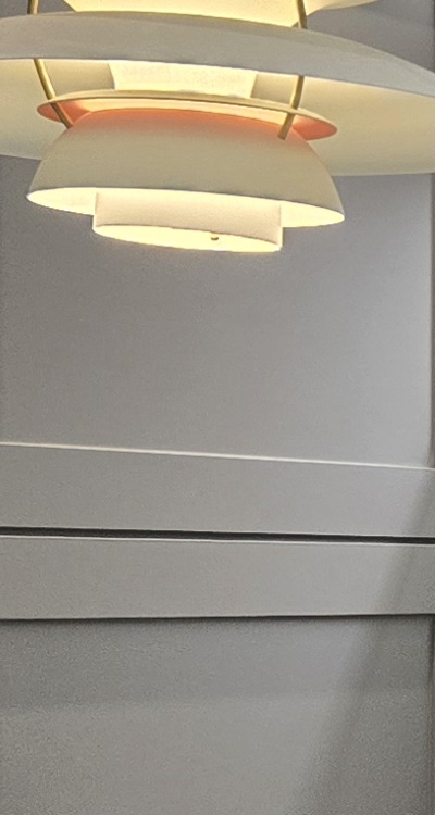 아래 사랑니 발치 통증 미리 알고 대처하려면 관련 이미지 22