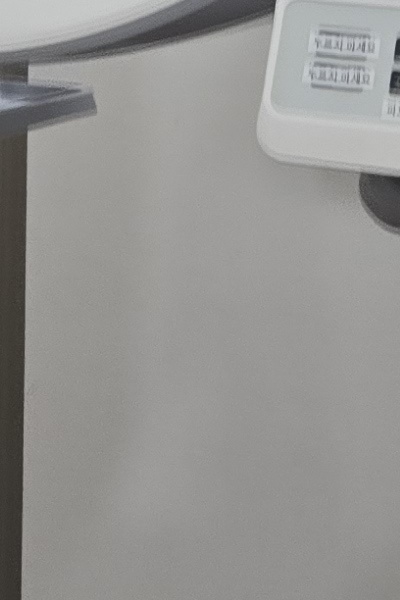 부정교합 교정 안하면 생기는 문제는 뭔가요 관련 이미지 44