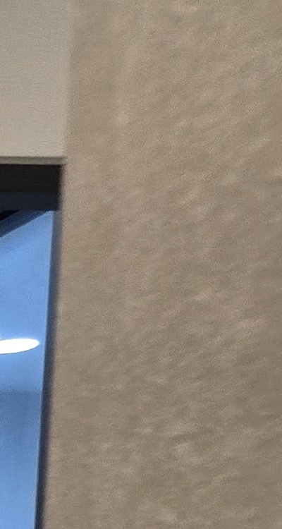 앞니 올세라믹 이건 알고 시작하세요 관련 이미지 19