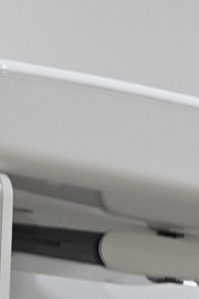 부정교합 교정 안하면 생기는 문제는 뭔가요 관련 이미지 21