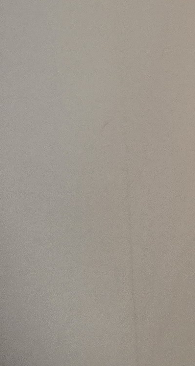 앞니 부분 교정 간단하니까 좋은건가요 관련 이미지 43