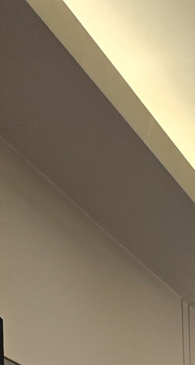 아말감 교체 레진 인레이 어떻게 대처하면 될까 관련 이미지 18