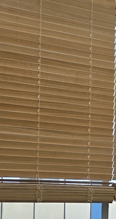 돌출입 팔자주름 교정 얼마나 바뀔까요 관련 이미지 24