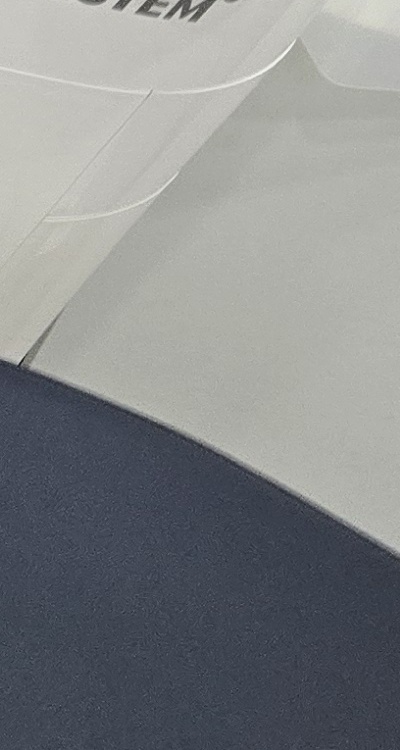 치아 사이 벌어짐 심해지는 이유부터 알아보면 관련 이미지 36