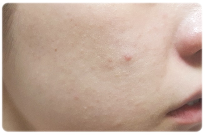 얼굴각질관리 꿀팁전수! 관련 이미지 7