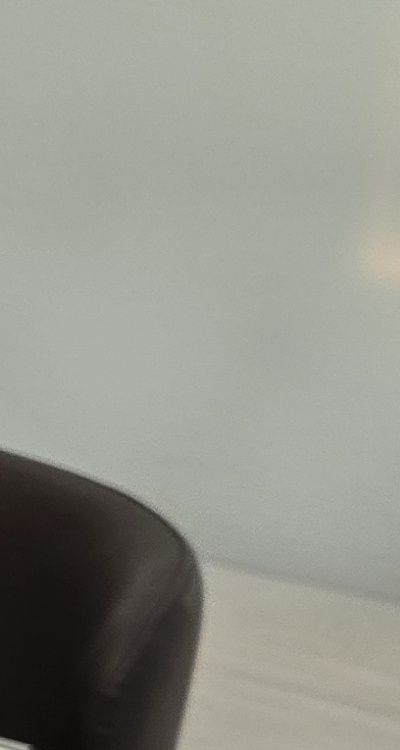 신경치료 아픈가요 망설이시는 분들이라면 관련 이미지 28