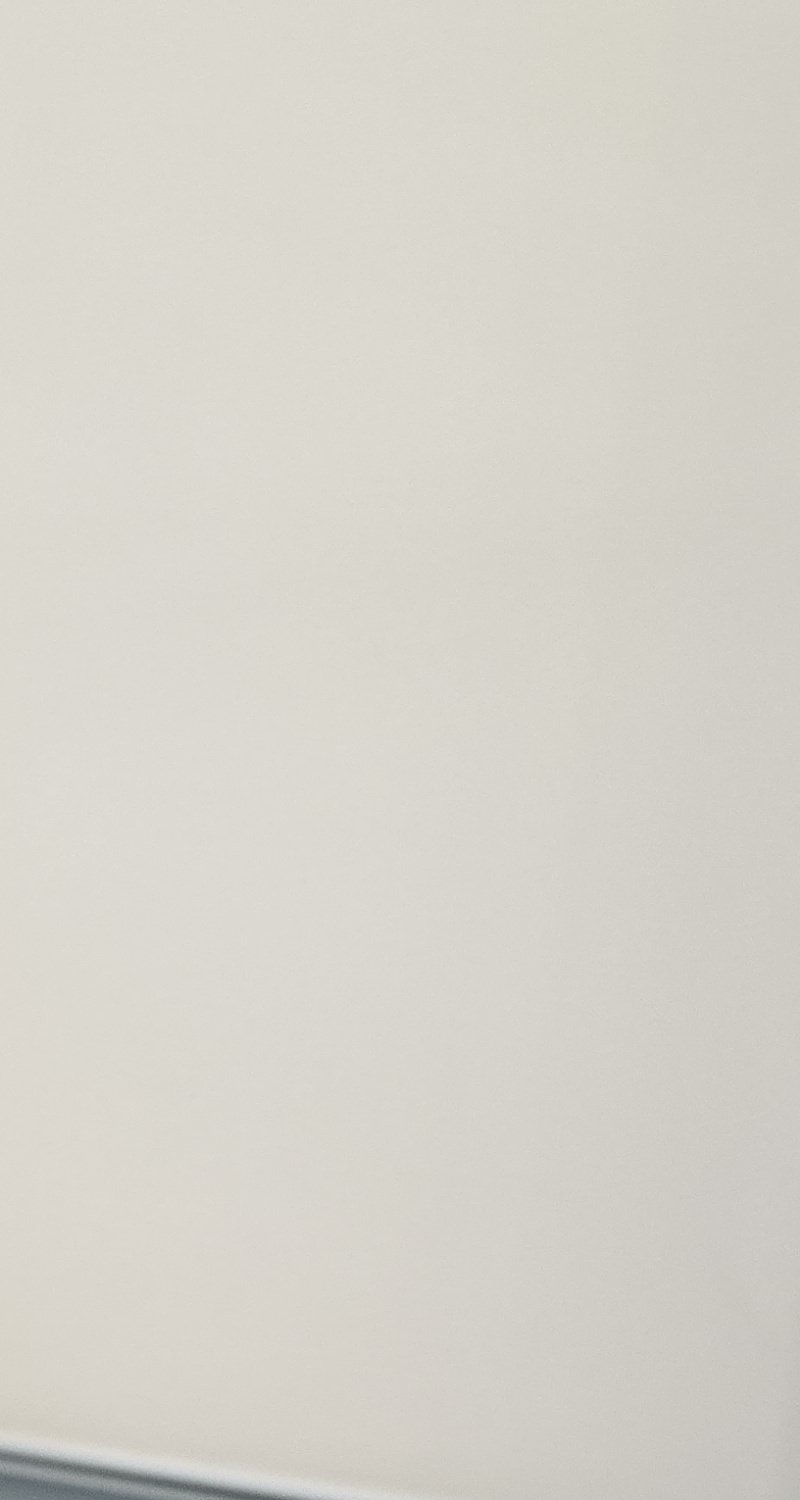 어금니 임플란트 뼈이식 이럴때 해당됩니다 관련 이미지 14