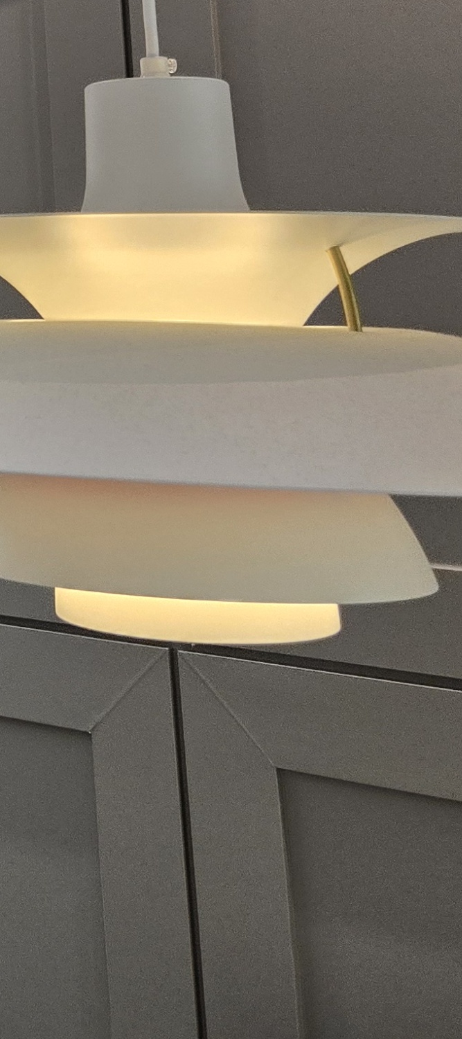 어금니 임플란트 뼈이식 이럴때 해당됩니다 관련 이미지 31