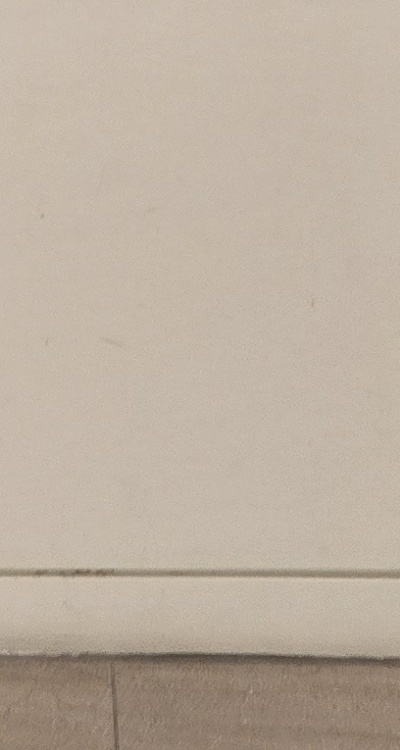 앞니 올세라믹 이건 알고 시작하세요 관련 이미지 45