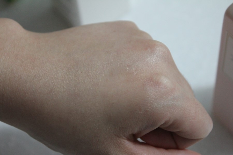 임산부 튼살 관리에는 몽디에스 마더 투비 로즈 아로마 멀티오일 관련 이미지 4