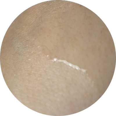 튼살오일 몽디에스 마더투비 6달동안의 사용기 관련 이미지 11