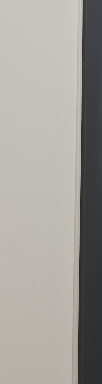 앞니 크라운 교체 깔끔하게 정리하려면 관련 이미지 22