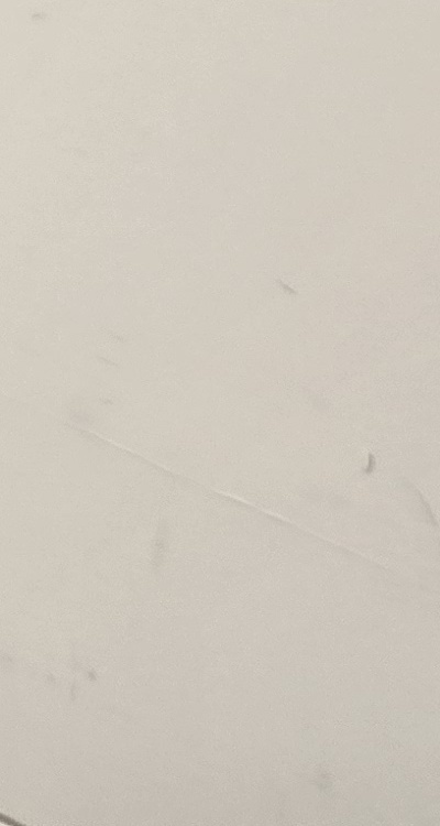 송곳니 크라운 티가 안나게 해결 가능한건가요 관련 이미지 45