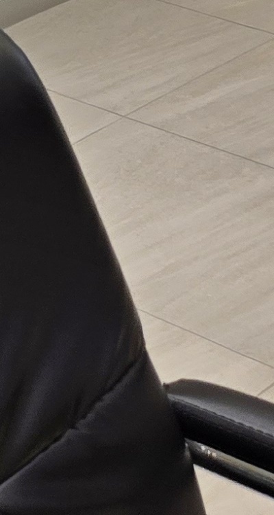 임플란트 뼈이식 안하면 어떤 문제가 있는거죠 관련 이미지 50