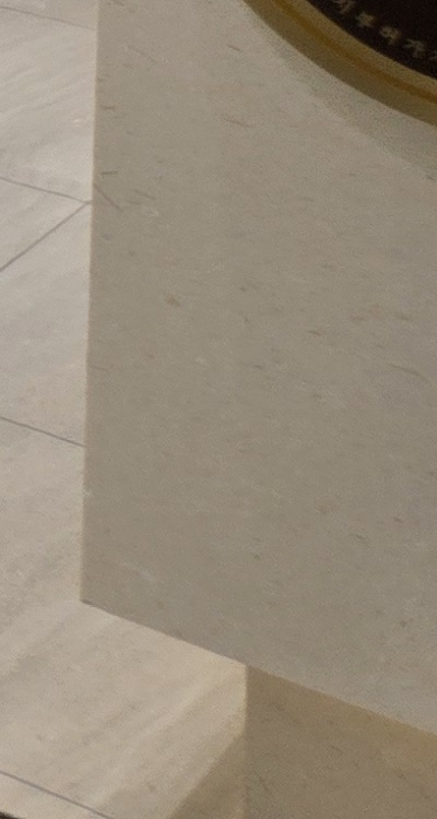 임플란트 뼈이식 안하면 어떤 문제가 있는거죠 관련 이미지 52